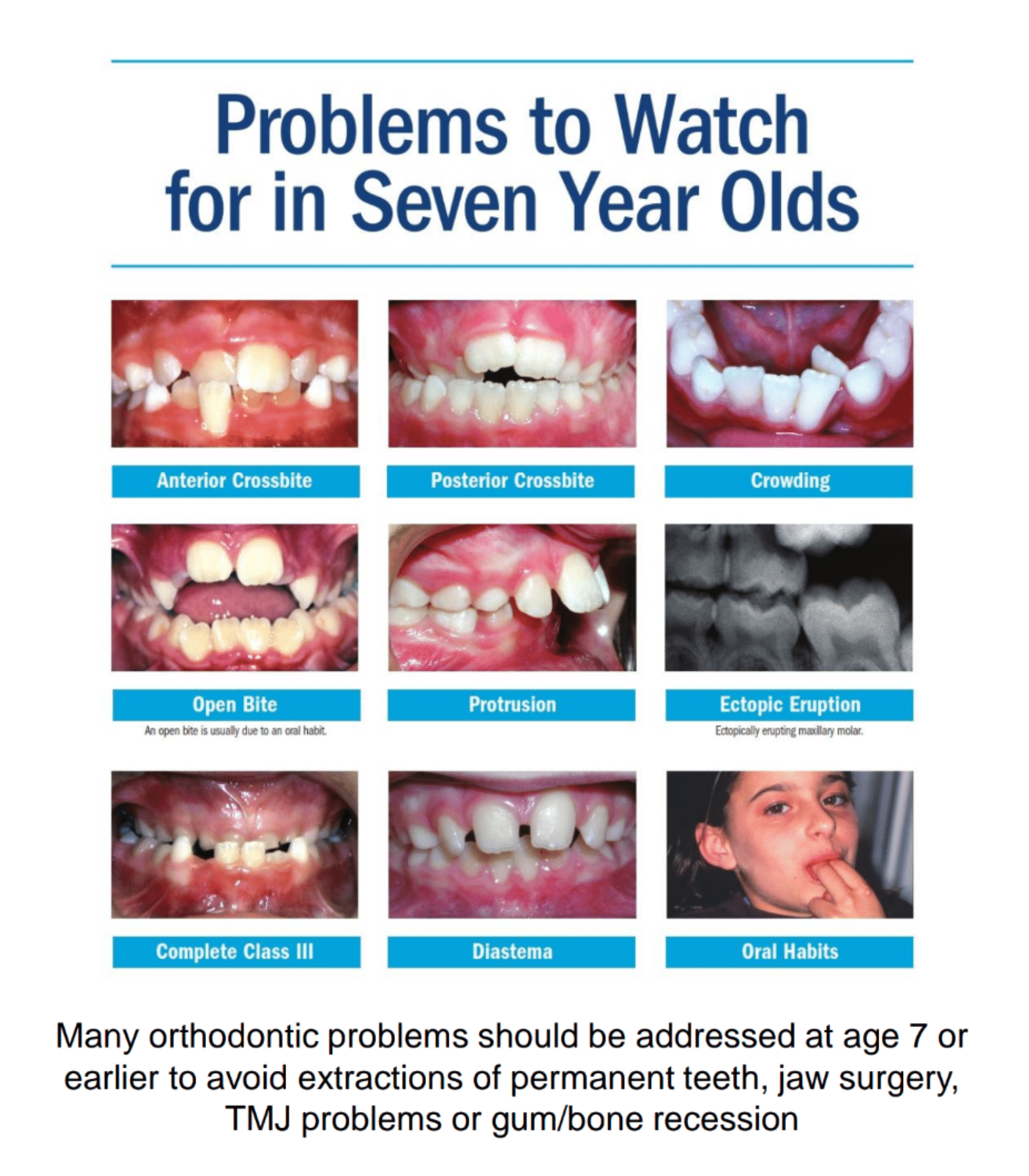 Orthodontic bite problems in children by age 7