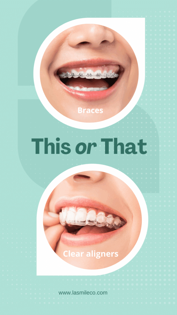 braces or clear aligners like invisalign